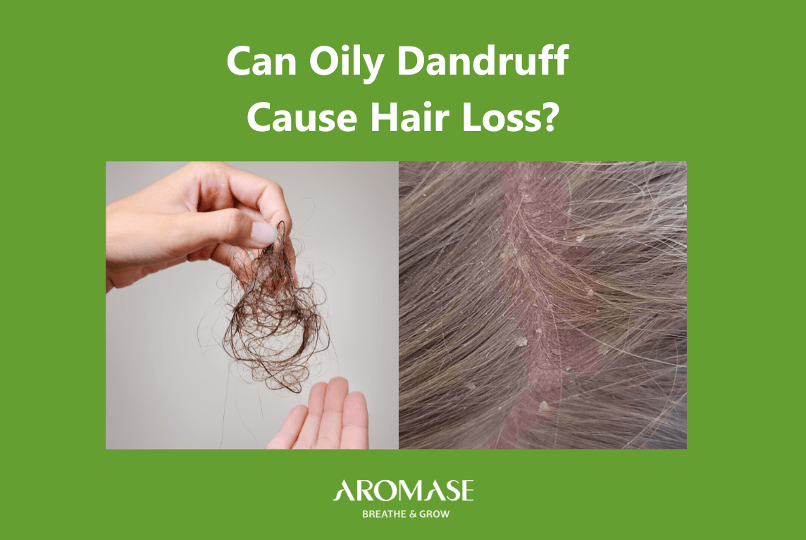 AROMASE oily dandruff and hair loss_4 connections (2)