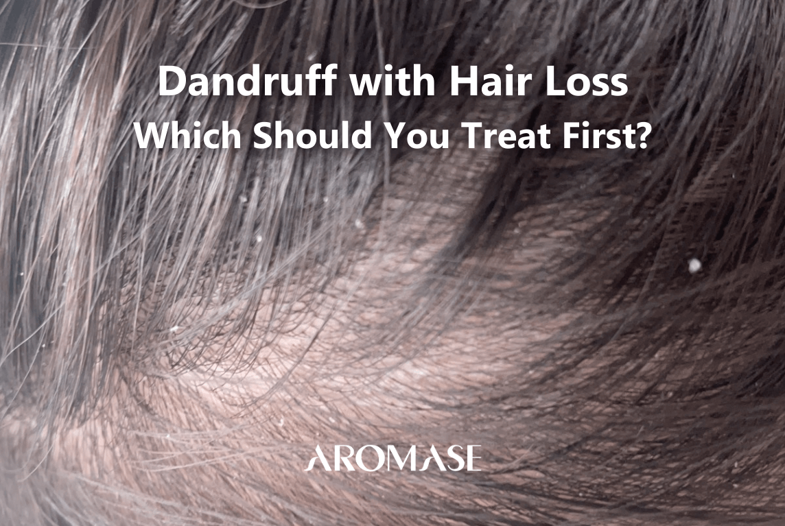 AROMASE scalp care Dandruff with Hair Loss Which Should You Treat First_flaky scalp