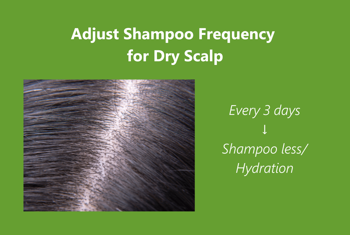 Colder Months Adjust Shampoo Frequency_AROMASE (2)_dry scalp