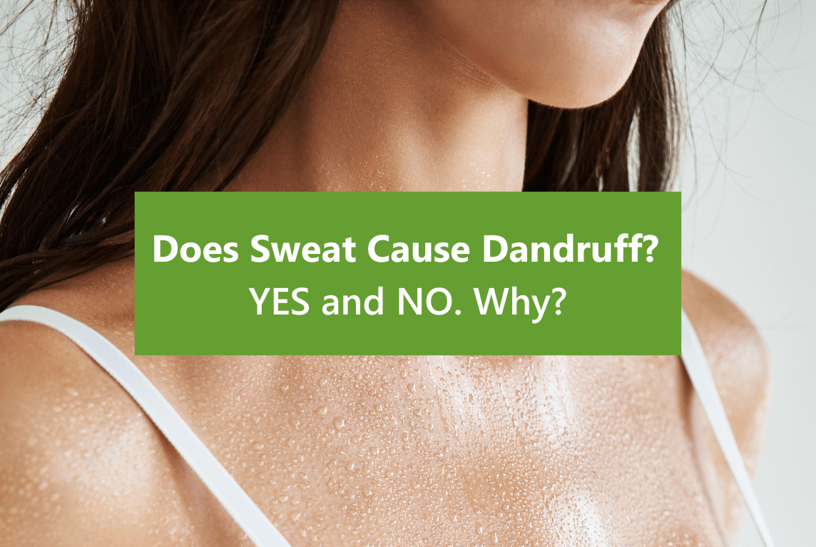 Does Sweat Cause Dandruff Understanding the Connection AROMASE scalp care (1)