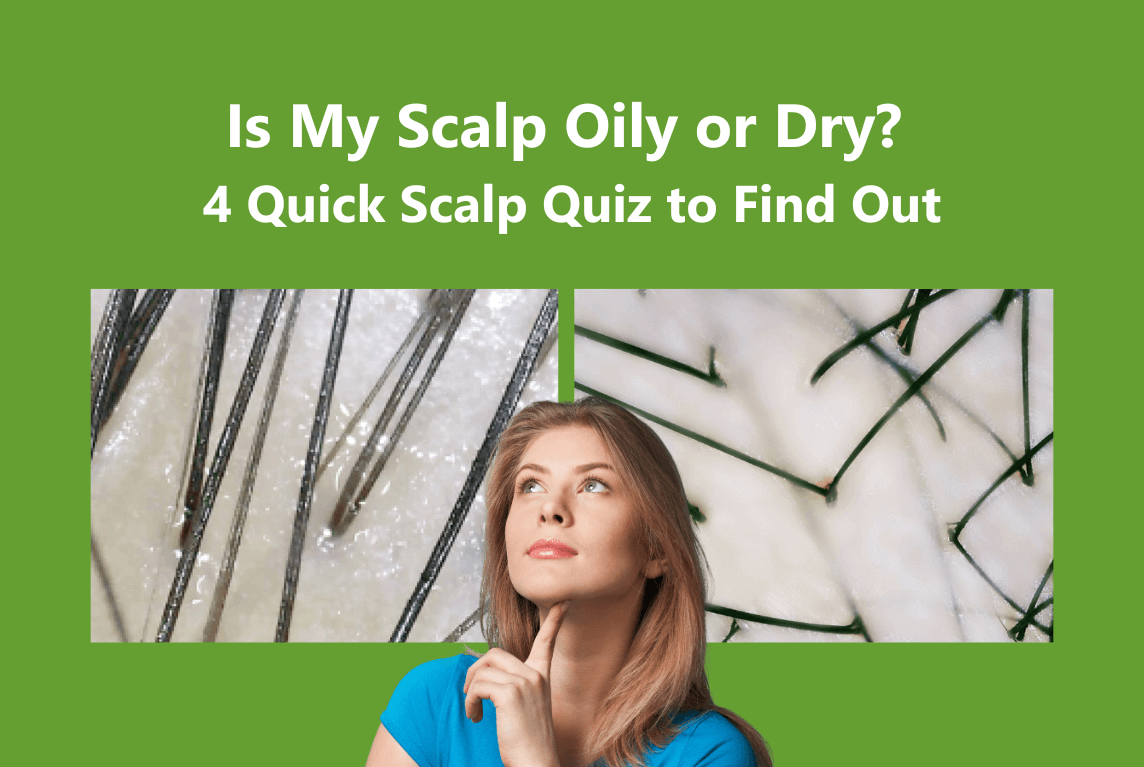 Is My Scalp Oily or Dry 4 Quick Scalp Quiz to Find Out_AROMASE scalp care