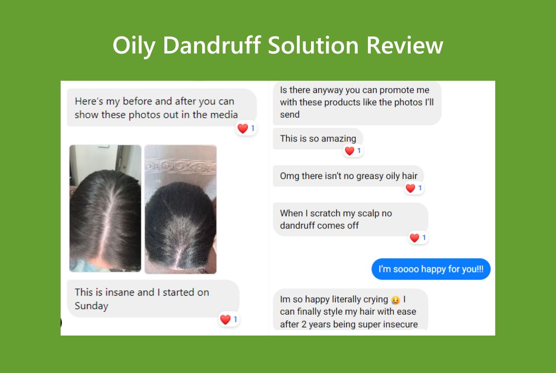 Oily Dandruff Sufferer 2-Year Journey and Solution Reviews AROMASE scalp care_3