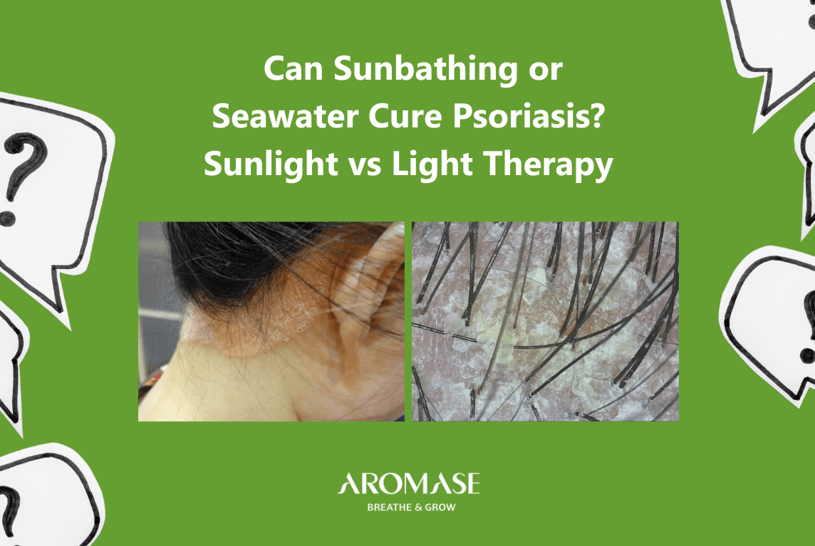 Psoriasis Is Sunbathing or Saltwater Safe Is Sunlight Better than Light Therapy